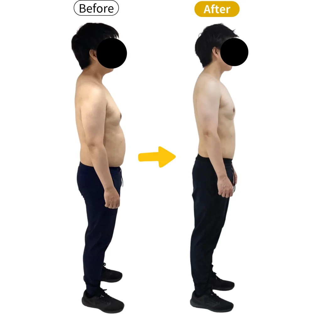 K.G様のビフォーアフター（横から）。左がBefore、右がAfter