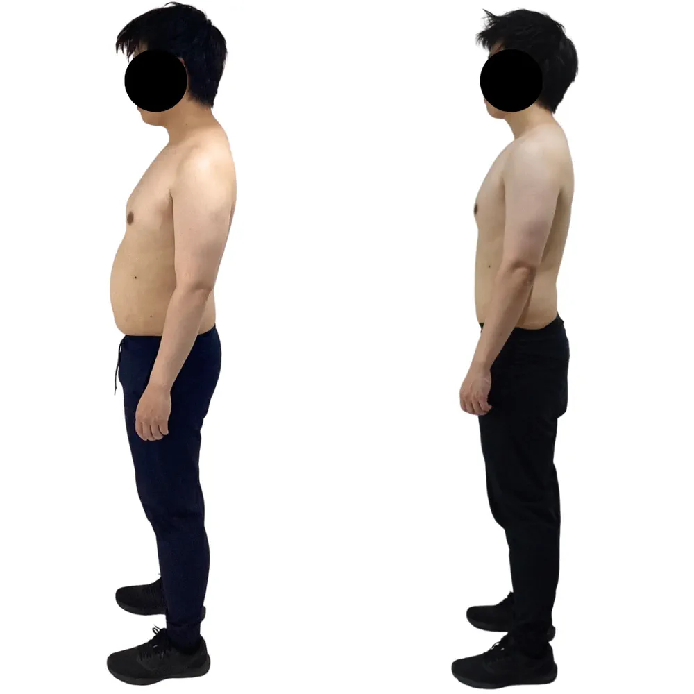 K.G様のビフォーアフター（反対側の横から）。左がBefore、右がAfter