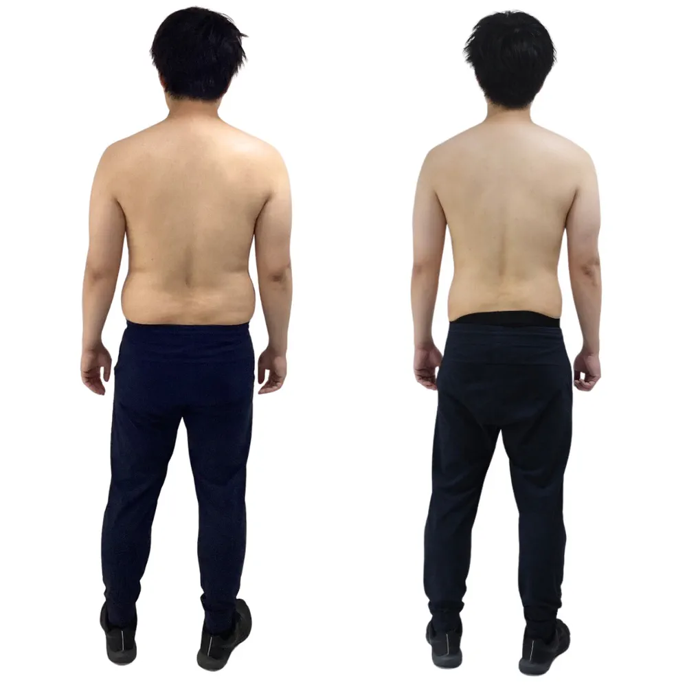 K.G様のビフォーアフター（後ろから）。左がBefore、右がAfter
