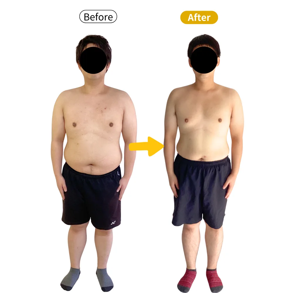 N.S様のビフォーアフター（正面から）。左がBefore、右がAfter