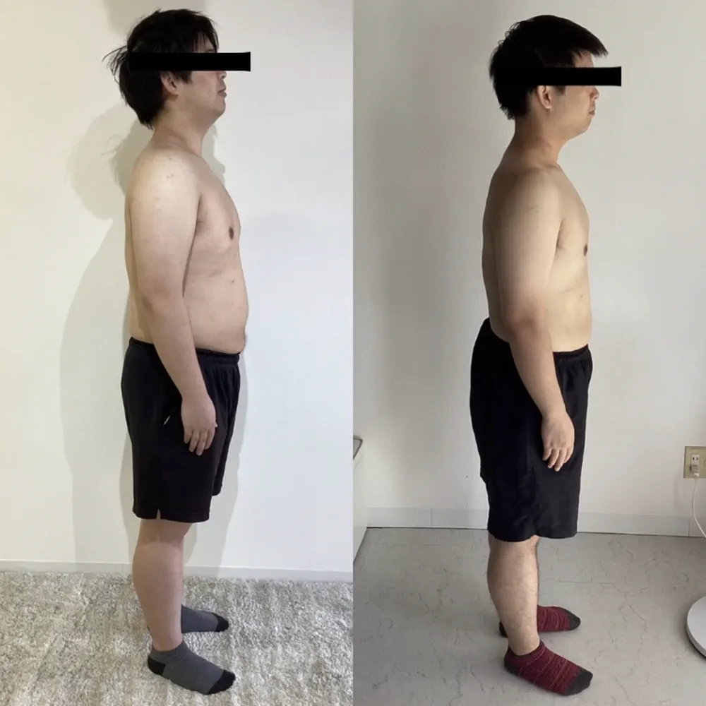 N.S様のビフォーアフター（横から）。左がBefore、右がAfter