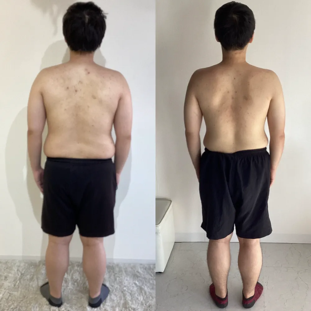 N.S様のビフォーアフター（後ろから）。左がBefore、右がAfter
