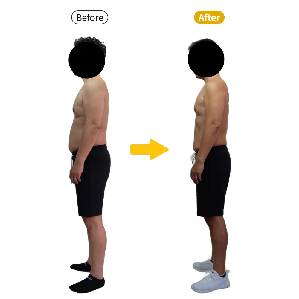 S.M様のビフォーアフター（横から）。左がBefore、右がAfter