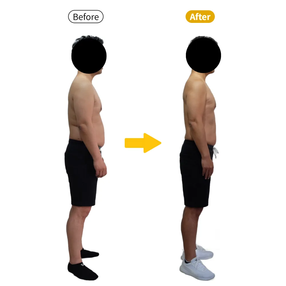 S.M様のビフォーアフター（反対側の横から）。左がBefore、右がAfter