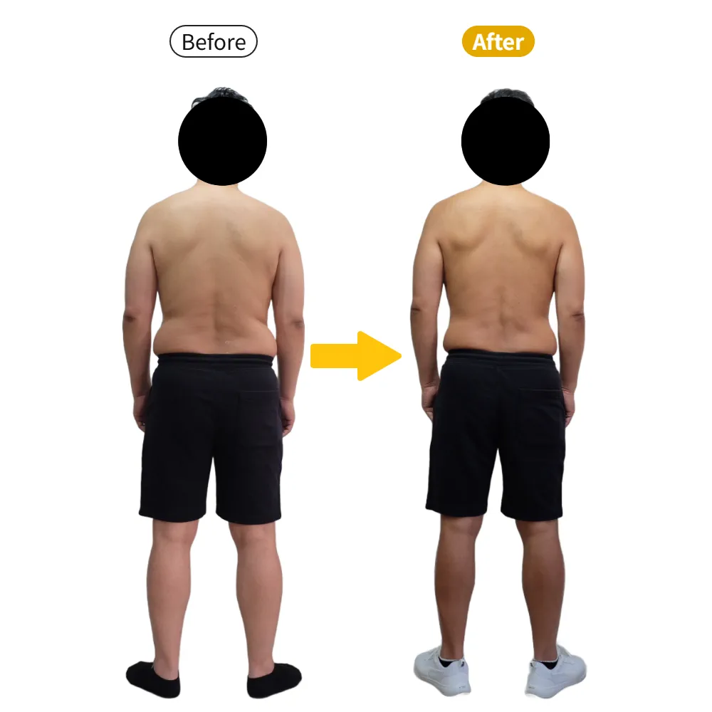 S.M様のビフォーアフター（後ろから）。左がBefore、右がAfter