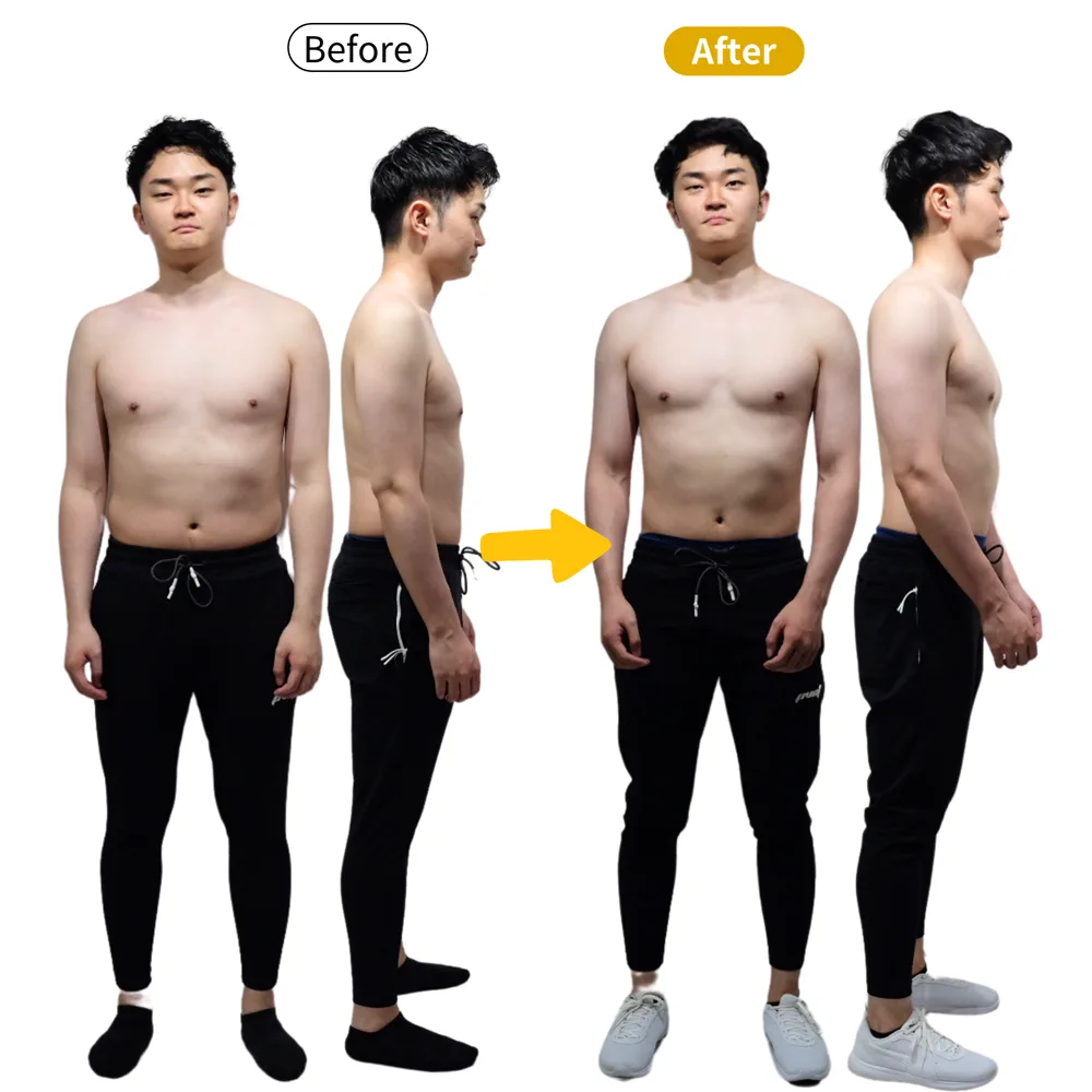 柴田凌佑様のビフォーアフター（正面と横から）。左がBefore、右がAfter