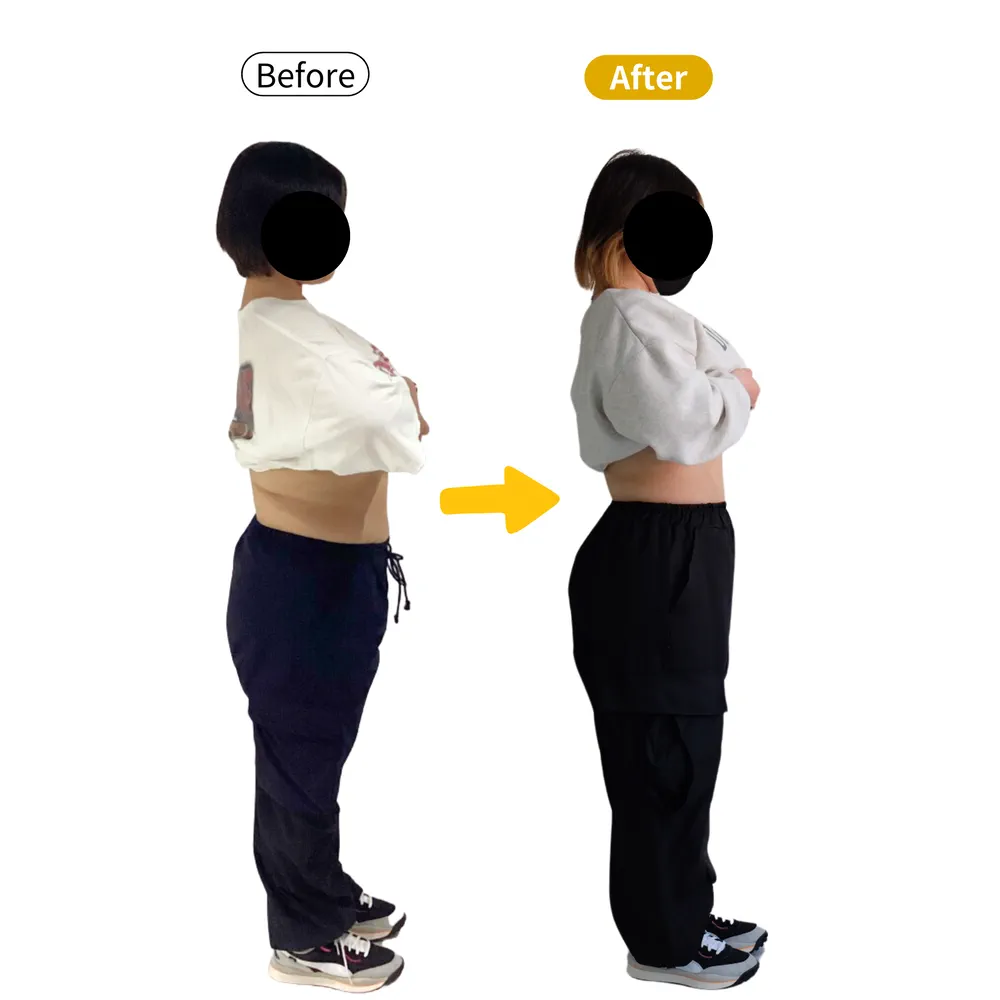 T.N様のビフォーアフター（横から）。左がBefore、右がAfter