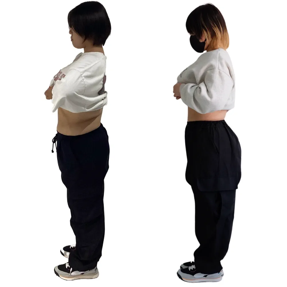 T.N様のビフォーアフター（反対側の横から）。左がBefore、右がAfter