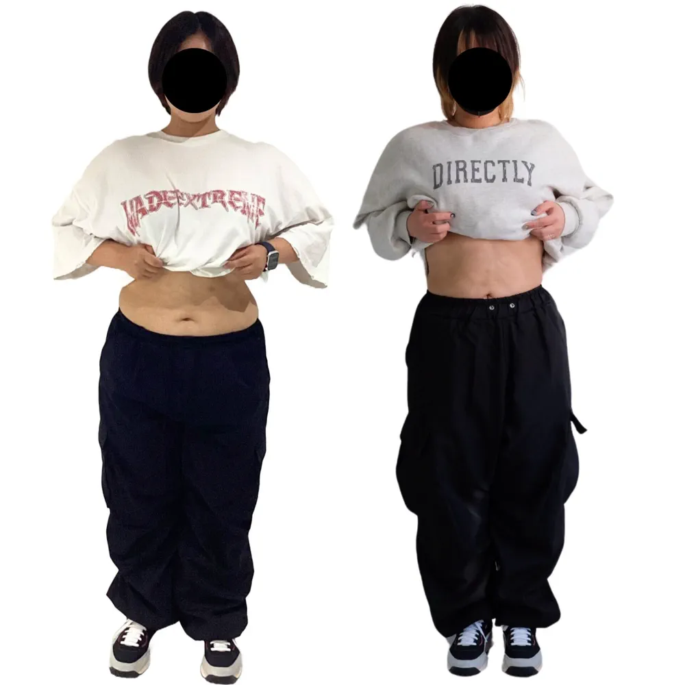 T.N様のビフォーアフター（正面から）。左がBefore、右がAfter
